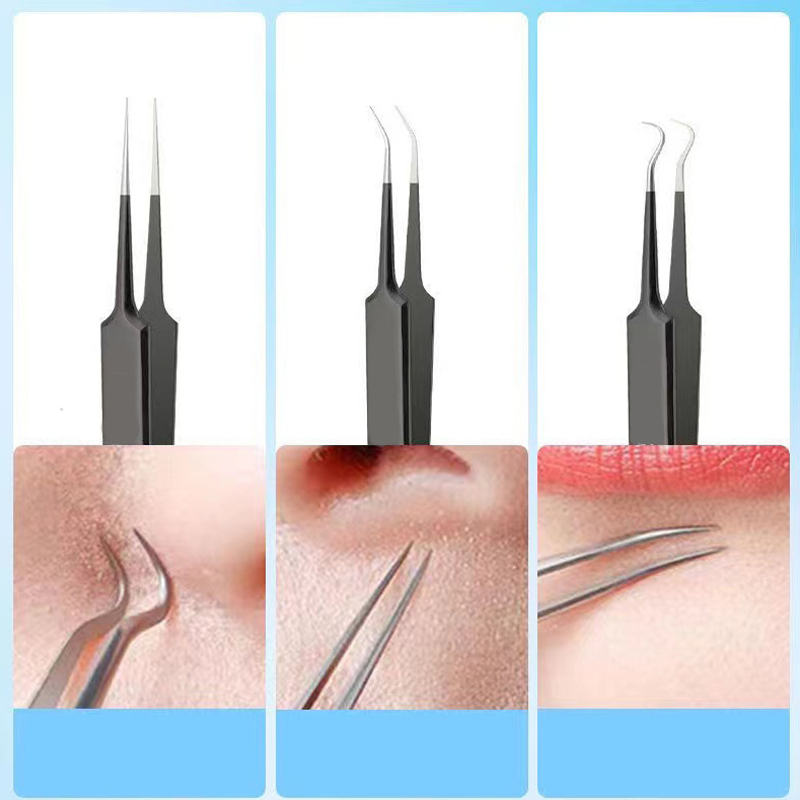 4/6PCS Face Cleaning Kit Pimpl - огляд і ціна Luxury Skincare Acne
