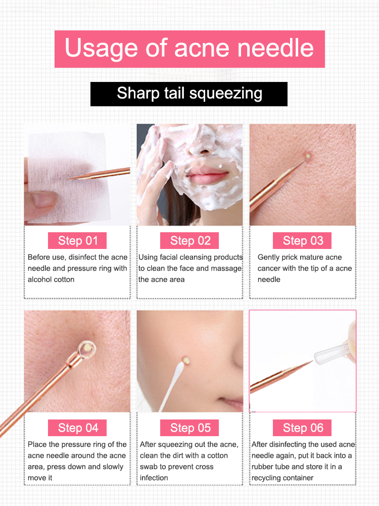Blackhead Remover Pimple Comed - огляд і ціна Luxury Skincare Acne