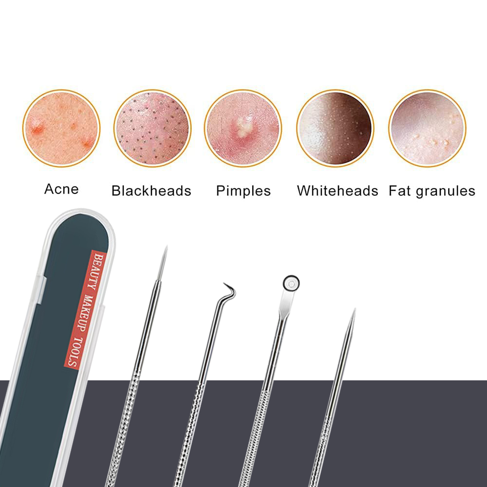 Pimple Popper Tool Kit Blackhe - огляд і ціна Luxury Skincare Acne