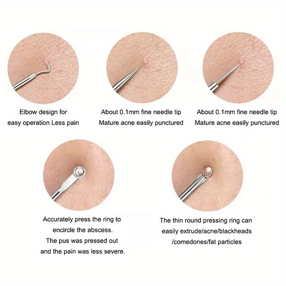 Pimple Popper Tool Kit Blackhe - огляд і ціна Luxury Skincare Acne