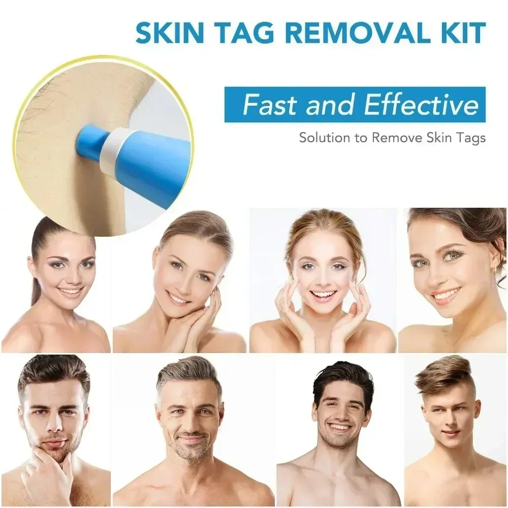 Acne Remover 2 IN 1 Auto Micro - огляд і ціна Luxury Skincare Acne