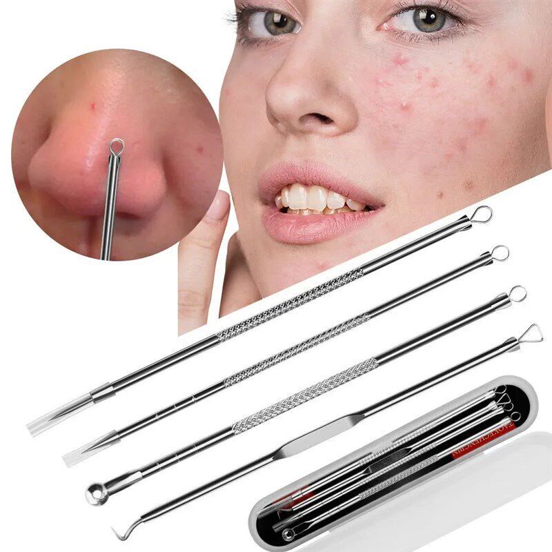 Blackhead Remover Tool Kit, St - огляд і ціна Luxury Skincare Acne