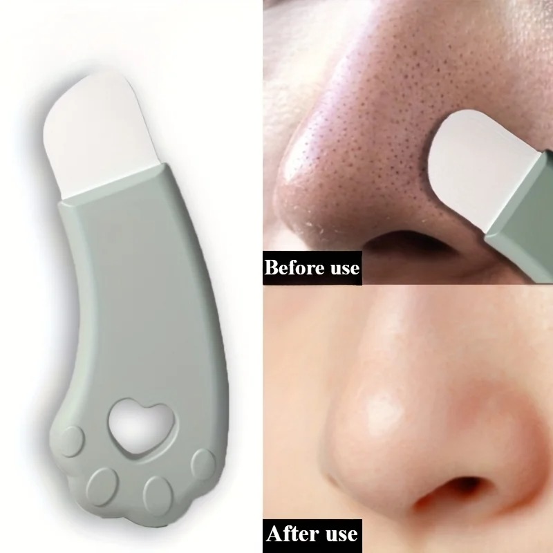 Cat Paw Blackhead Remover Tool - огляд і ціна Luxury Skincare Acne